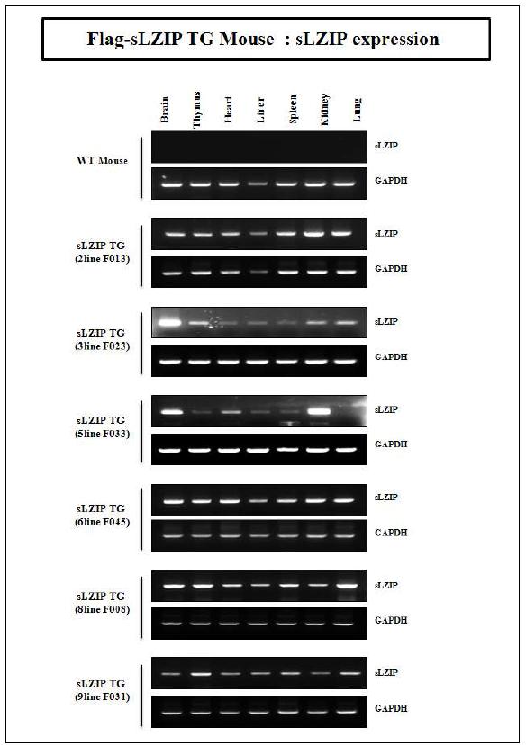 형질전환 mouse의 각 조직에서 line별 sLZIP의 발현 유무를 보여주는 결과.