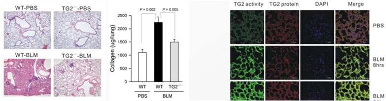 TG2(-/-) mice의 bleomycin-induced fibrosis에 대한 내성.