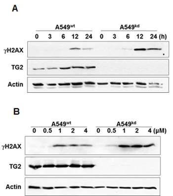 TG2 knockdown A549 세포주에서 유전독성 자극에 의한 γH2AX 형성 (A) GFP나 TG2 knockdown A549 세포주에 doxorubicin (2 μM)을 처리 후, γH2AX의 발현양 관찰. (B) A549 세포주에 여러농도의 doxorubicin을 24시간 처리 후, γH2AX의 발현양 관찰.