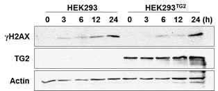 TG2 과발현 HEK293 세포주에서 유전독성 자극에 의한 γH2AX 형성. TG2 과발현 HEK293 세포주에 doxorubicin (2 μM)을 처리 후, γH2AX의 발현양 관찰.