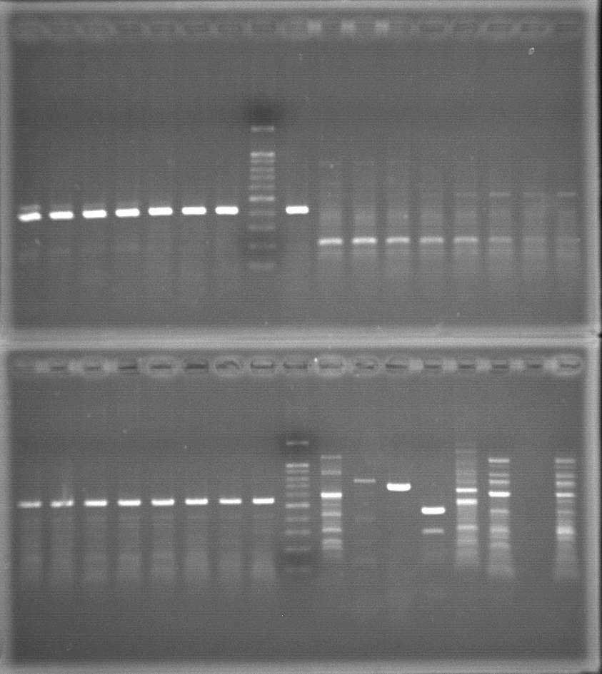 엑솜 시퀀싱의 후보 유전자 Validation을 위한 PCR 조건확립
