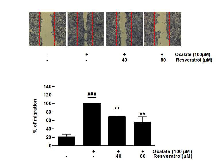 Resveratrol의 신장 상피세포에서의 resveratrol 이 oxalate 에 의한 신장 세포의 이동 억제