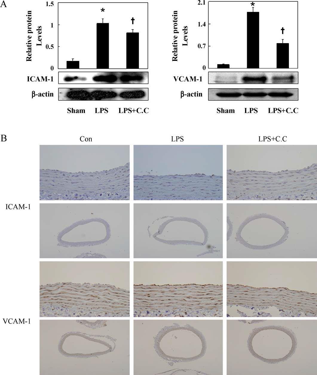 Effect of compound C treatment on VCAM-1 and ICAM-1 expression in the aorta of LPS-treated rats. Compound C (0.2 mg/kg) was administrated (i.v.) 30 min before LPS (10 mg/kg) injection. Six hours later rats were anesthetized and thoracic aortas were collected for western blotting and immunohistochemistry, respectively. Relative protein levels (ICAM-1 or VCAM-1/-actin) in sham (n = 3), LPS (n = 3), and LPS with compound C (LPS + C.C., n = 3) were shown in A. Representative images of ICAM-1 and VCAM-1 immunoreactivity (B) for aortic sections of control (CTL), LPS, and LPS with compound C (LPS + C.C.). Of note, the increased VCAM-1 and ICAM-1 immunoreactivity in the aortic endothelium of LPS-treated rats were decreased by compound C.