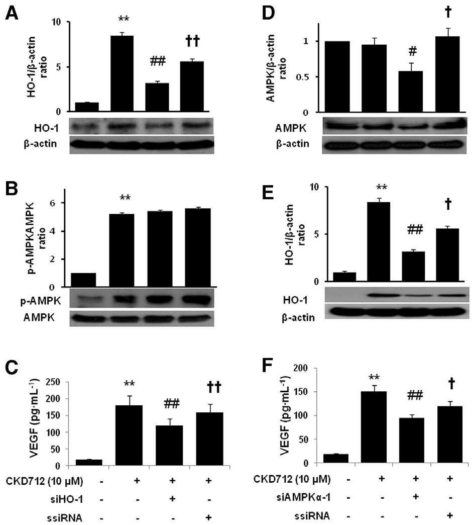 Effect of siRNA transfection on the CKD712-mediated expression of HO-1 and AMPK and VEGF production in HDFs. After transfection with HO-1- or AMPK-siRNA, the cells were treated with CKD712 (10 mM) for 24 h (A) or 12 h (B). Then cells were harvested and analysed by Western blotting for HO-1 (A, E) or AMPK (B, D). The cells were treated with CKD712 (10 mM) for 12 h, and culture medium samples were collected and subjected to ELISA for VEGF (C, F). The data are presented as the mean SD of three independent experiments.