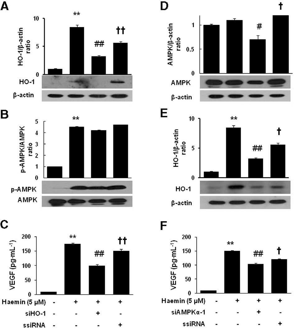 Effect of siRNA transfection on the expression of HO-1, AMPK and VEGF production induced by haemin in HDFs. After transfection with the corresponding siRNA, the cells were treated with haemin (15 mM) for 24 h (A) or 12 h (B). The cells were harvested and analysed by Western blotting for HO-1 (A, E) or for AMPK (B, D). The cells were treated with haemin (15 mM) for 12 h, and culture medium samples were collected and subjected to ELISA for VEGF (C, F). The data are presented as the mean SD of three independent experiments.