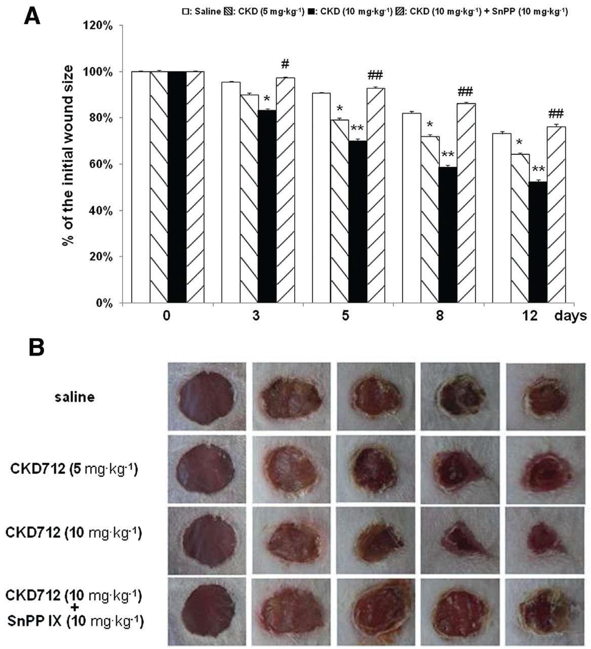 The wound closure induced by CKD712 is antagonized by SnPPIX in an animal wound model. Two full-thickness 5-mm punch wounds were inflicted on the dorsal surface of each mouse, and the mice were injected (i.p) with saline, CKD712 (5 mg·kg-1), CKD712 (10 mg·kg-1) or CKD712 (10 mg·kg-1 plus SnPPIX (10 mg·kg-1). The time course of the changes in the wound size with different treatments in mice (A). Images of a representative mouse from each group taken on post-injury days 0, 3, 5, 8 and 12 are shown (B). The wound sizes at the indicated time points in topically treated mice.