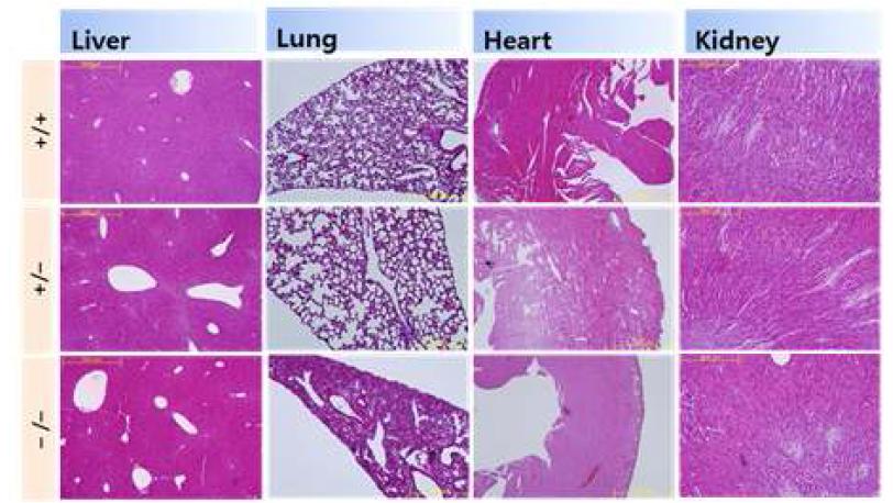 VDUP-1 KO 마우스의 조직 염색상