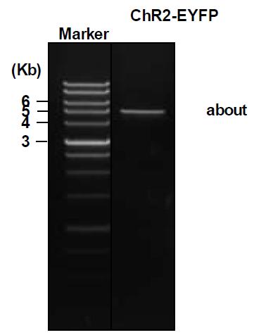 rGnRH- ChR2- EYFP DNA dilysis후 확인