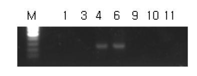 rGnRH- ChR2- EYFP genotyping결과