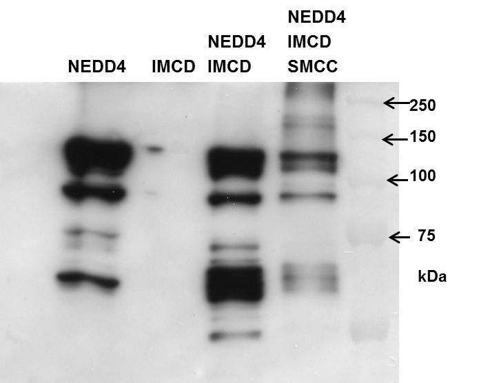 그림. SMCC에 의해 crosslinking 된 NEDD4-NEDD4특이 기질 단백 복합체를 NEDD4 항체를 이용하여 확인함.