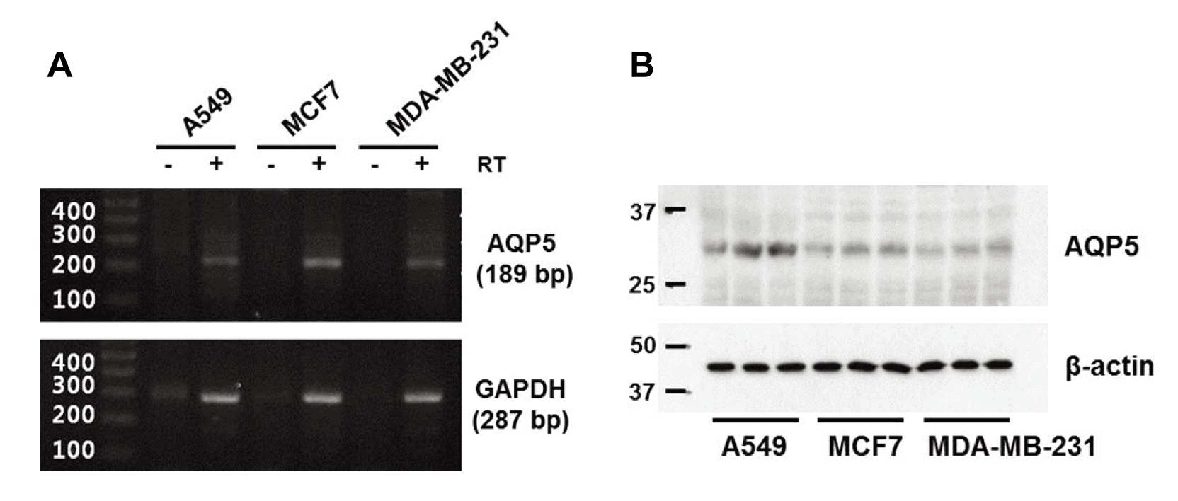 그림. 유방암 세포주인 MCF-7 세포에서의 AQP5의 mRNA (A)와 단백질 (B) 발현 확인.