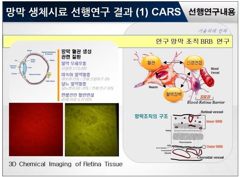 CARS를 이용한 Retina tissue 의 3D chemical image