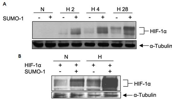 그림 5. SUMO-1이 HIF-1α 안정성에 미치는 영향