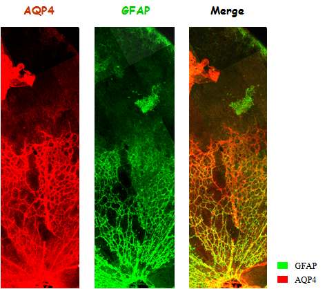 그림 21. 성상세포 말단에서 Aquaporin-4의 발현