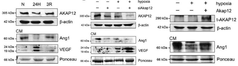 그림 23. AKAP12에 의한 Ang1과 VEGF의 발현조절