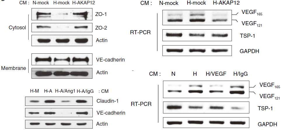 그림 24. AKAP12에 의한 VEGF, TSP-1, ZO-1, ZO-2, Claudin-1, VE-cadherin의 발현조절