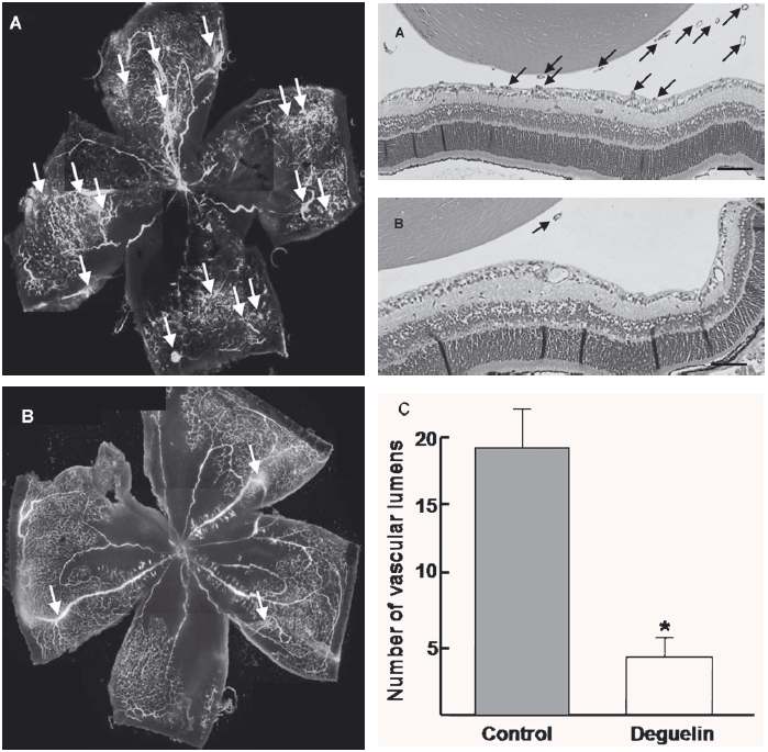그림 26. OIR 생쥐 모델에서 Deguelin에 의한 망막혈관신생억제