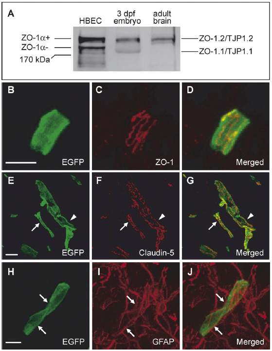 그림 32. Transgenic zebrafish(fli1:EGFP) 혈관내피세포의 tight junction 단백질의 발현을 통한 뇌혈액관문의 존재 확인