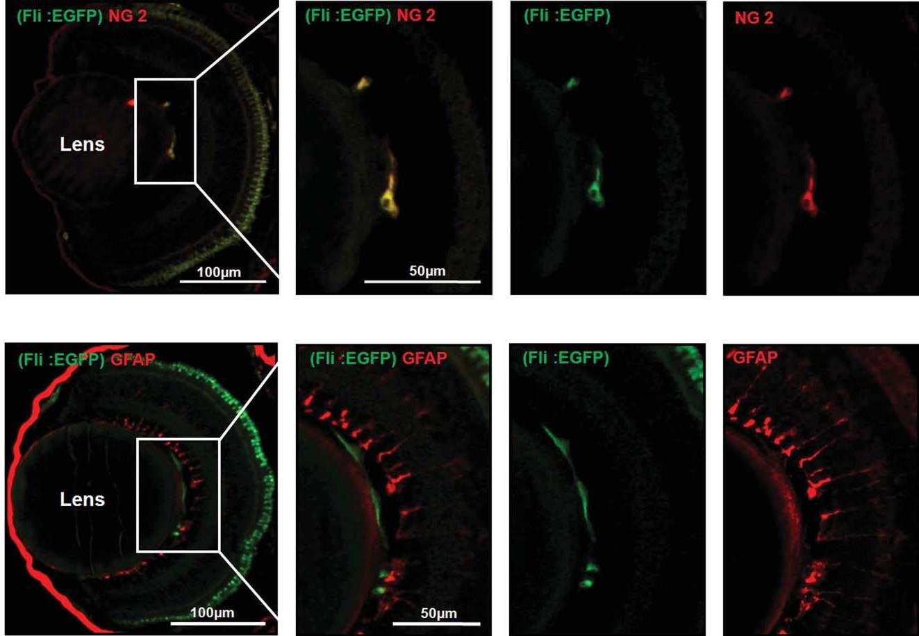 그림 33. Transgenic zebrafish(fli1:EGFP) hyaloid-retinal vessel에서 존재하는 pericyte
