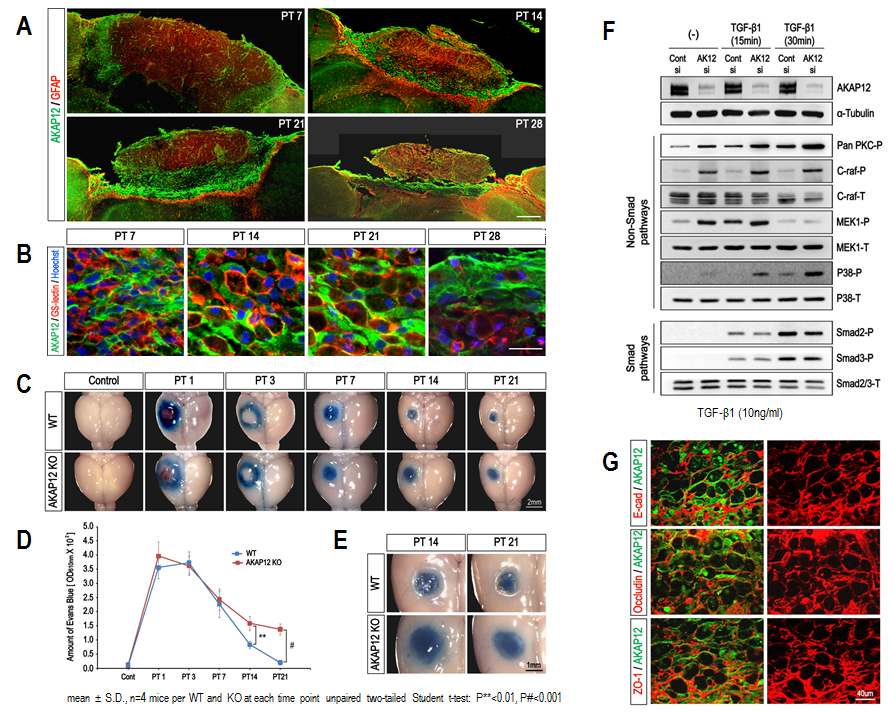 그림 37. 국소적 뇌 손상시 fibrotic-glial scar 형성과정에 미치는 AKAP12의 역할