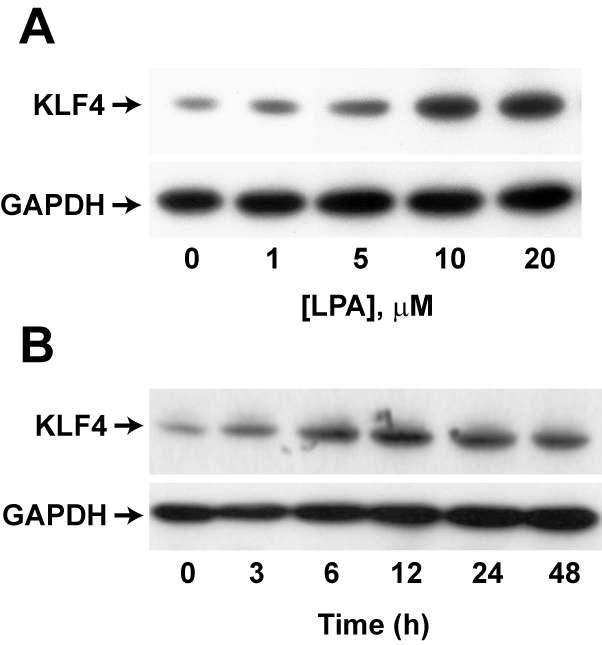 그림 14: K LF4의 발현촉진인자로서 LPA 의 발견