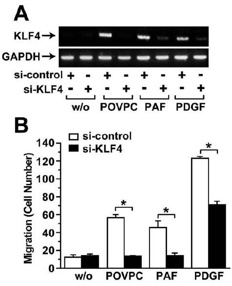 그림 15: POVPC, PA F에 의한 세포이동과정에 KLF4의 역할