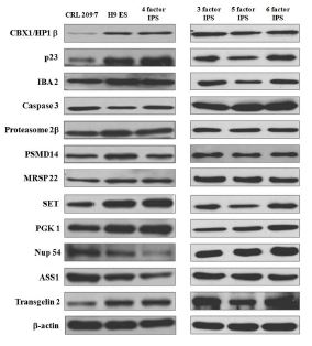 그림 25. Western blot 실험을 통한 발굴 단백질의 검증