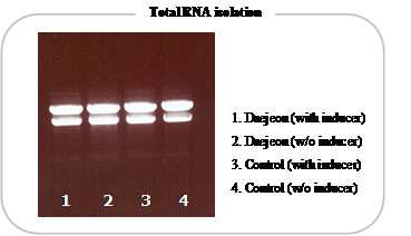 RNA 전기영동.