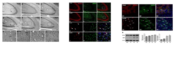 그림 9. TonEBP and AQP4 expression in kainic acid (KA)-induced cell death and astrocyte activation.