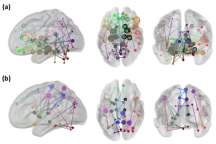 그림 51. 확산텐서영상을 이용한 건강인 집단이 통계적 유의성이 높은 node degree의 영역 (a), 휴면 기능자기공명영상을 이용한 건강인 집단이 통계적 유의성이 높은 node degree의 영역 (b)