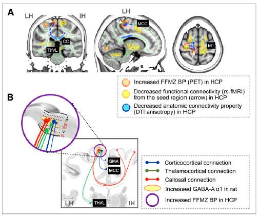그림 75. 뇌영상 결과와 동물모델 결과. (A) FFMZ PET 결합잠재능 (BP)가 감소된 영역에서 기능적연결성과 분할비등방도(FA)가 모두 감소하였다. (B) 편마비 환자의 운동역역의 감소된 기능적 연결성과 그에 관련된 GABA-A 수용기 α1의 증가와 관련된 피질의 Ⅲ, Ⅳ, Ⅵ 층.
