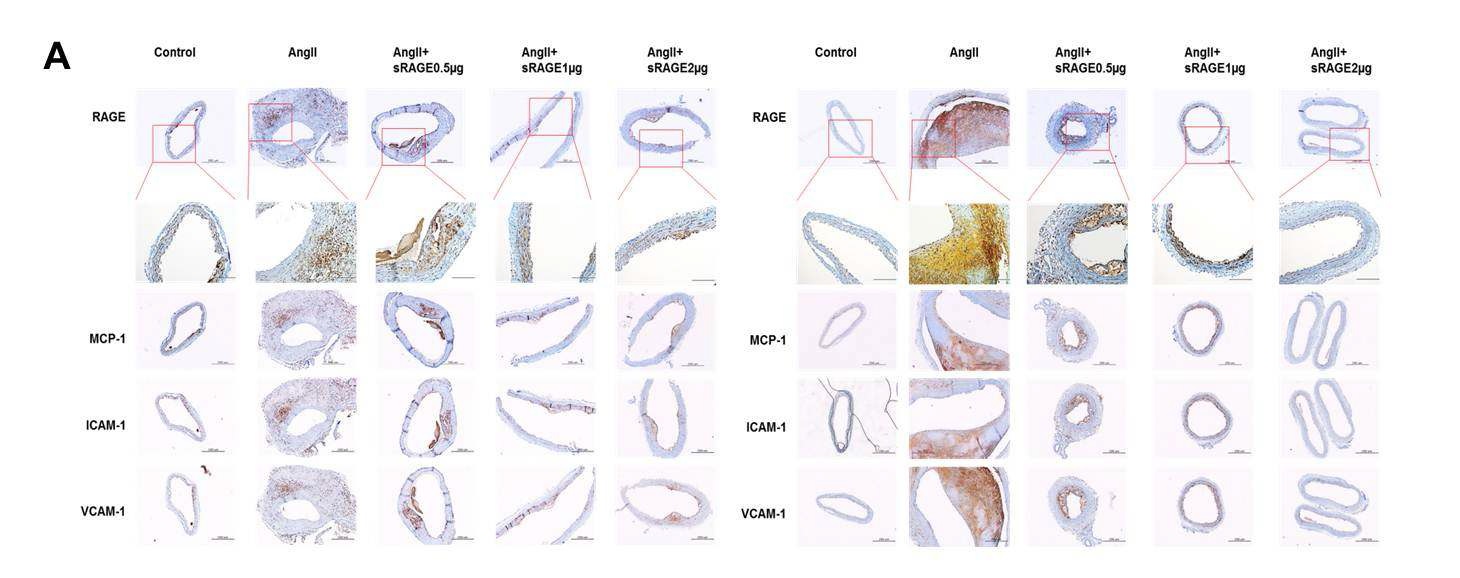 그림 9. Development of atherosclerotic lesion in ApoE KO mice.