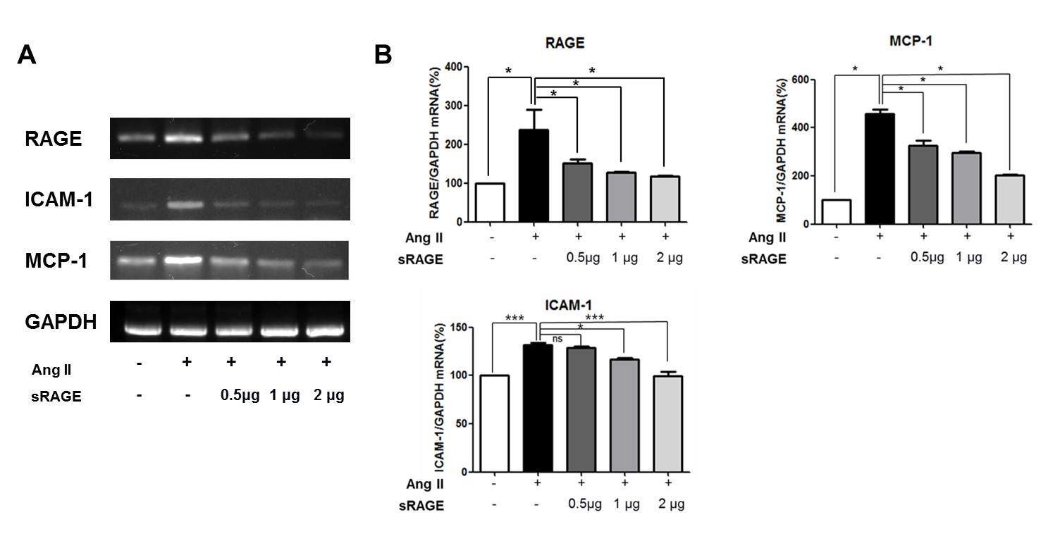 그림 8. Effects of sRAGE on mRNA level in aorta of AngII-induced ApoE KO mice.