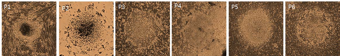 선별된 유도만능 줄기세포의 각 passage 에서의 대표적인 이미지 사진.