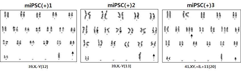 pathway inhibitor가 있는 조건에서 배양한 mouse 유도만능 줄기세포의 karyotyping 결과