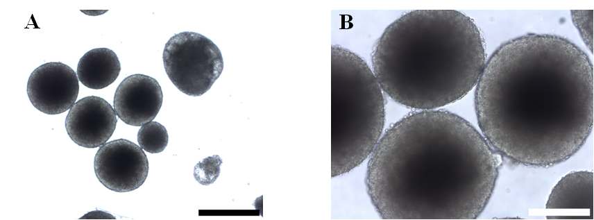 그림 5. 형성된 Embryoid Body의 광학 사진. A: 40배, B: 100배