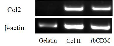 그림 9. RT-PCR을 통한 유도만능 줄기세포의 연골 세포로의 분화 확인