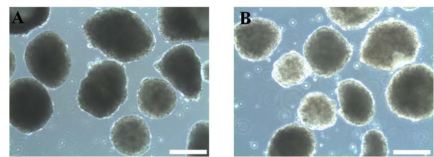 그림 14. BMP-4, FGF2를 4일간 처리한 인간줄기세포의 배상체 (A)와 처리하지 않은 배상체 (B)의 광학 현미경 사진
