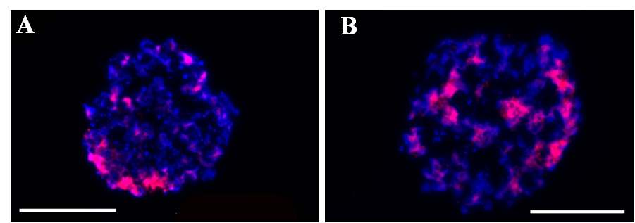 그림 16. brachyury 항체를 이용한 면역 염색 사진 A : BMP-4, FGF2를 4일간 처리한 인간줄기세포의 배상체 B: BMP-4, FGF2를 처리하지 않은 배상체