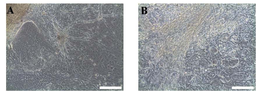 그림 17. 14일간 골세포 분화배지로 분화가 유도된 인간배아줄기세포 배상체의 광학사진 A : BMP-4, FGF2를 4일간 처리한 인간줄기세포의 배상체 B: BMP-4, FGF2를 처리하지 않은 인간 배아줄기세포의 배상체
