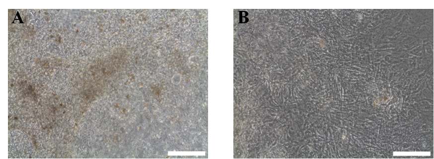 그림 19. Von Kossa 염색을 통한 칼슘 확인 A : BMP-4, FGF2를 4일간 처리한 인간줄기세포의 배상체 B: BMP-4, FGF2를 처리하지 않은 인간 배아줄기세포의 배상체