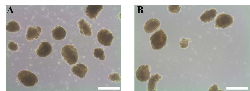 그림 21. 중배엽 분화 유도된 인간배아줄기세포 배상체 (A)와 유도되지 않은 배상체 (B)의 연골분화 14일 후의 광학 사진