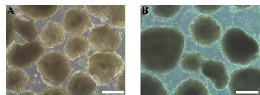 그림 31. 인간 중간엽 줄기세포 조정배지로 4일간 배양된 인간줄기세포의 배상체 (A)와 일반 배상체 배양 배지로 배양된 배상체 (B)의 광학 현미경 사진.
