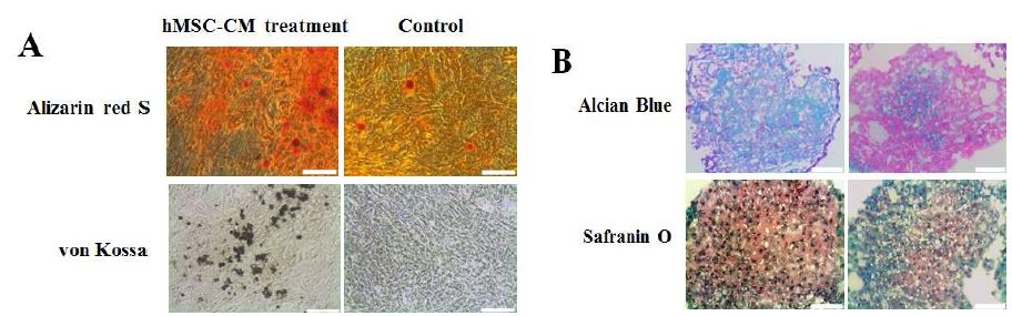 그림 34. (A) Alizarin red S와 von Kossa 염색을 통한 골세포로 분화된 인간 중간엽 줄기세포 조정배지로 배양된 인간배아줄기세포 배상체 (hMSC-Cm treatment)와 일반 배상체 배양 배지로 배양된 인간배아줄기세포 배상체 (Control)의 칼슘 침착 확인 (B) Alcian Blue 염색과 Safranin O 염색을 통한 연골 세포로 분화된 인간중간엽 줄기세포 조정배지로 배양된 인간배아줄기세포 배상체 (hMSC-Cm treatment)와 일반 배상체 배양 배지로 배양된 인간배아줄기세포 배상체 (Control)의 연골 특이적 sulfated proteoglycans 과 sulfated glycosaminoglycans 확인.