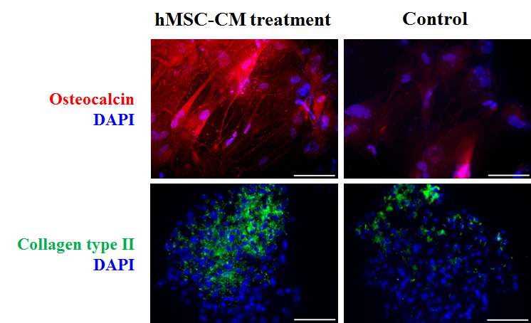 그림 35. 14일간 골세포, 연골세포로의 분화 된 인간 중간엽 줄기세포 조정배지로 배양된 인간배아줄기세포 배상체 (hMSC-Cm treatment)와 일반 배상체 배양 배지로 배양된 인간배아줄기세포 배상체 (Control) 의 Osteocalcin (붉은색), Collagen type II (녹색) 항체를 이용한 면역염색. 세포 핵은 DAPI (푸른색)로 대조 염색하였음