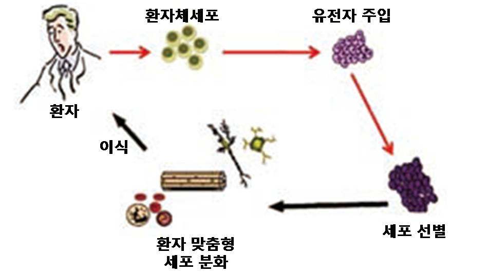 그림1. 환자의 체세포를 이용한 다능성 줄기세포 생산 및 이식 과정