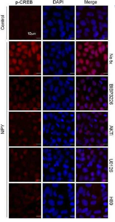 3 μM BIBP3226, 10 μM AKTi, 10μM U0126 또는 10 μM H89로 1시간 사전처리 유무에 따라 5분 동안 NPY로 처리한 인간 배아줄기세포의 면역조직화학 분석 결과