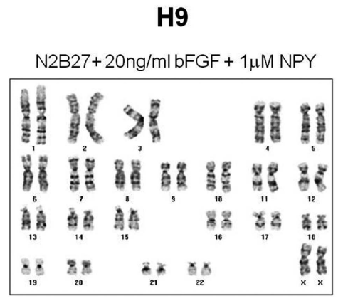 6 계대( passages) 동안 NPY N2/B27 배지에서 배양된 H9 hESC의 핵형 분석 결과