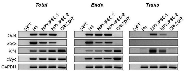 NPY를 첨가한 배양조건에서 제작한 유도만능줄기세포에서의 인간배아줄기세포 특이 마커 발현의 RT-PCR 분석 결과