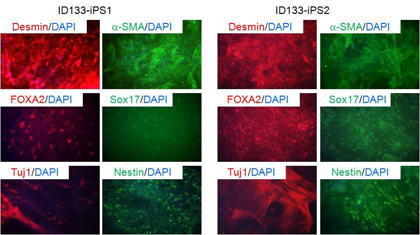 ID133-hiPSC의 in vitro 삼배엽 분화능
